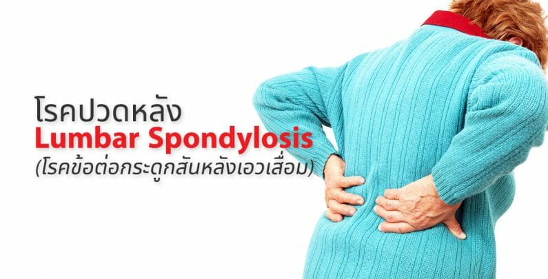 โรคปวดหลัง Lumbar spondylosis